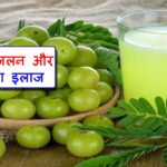 Acidity And Gas Home Remedies in Hindi