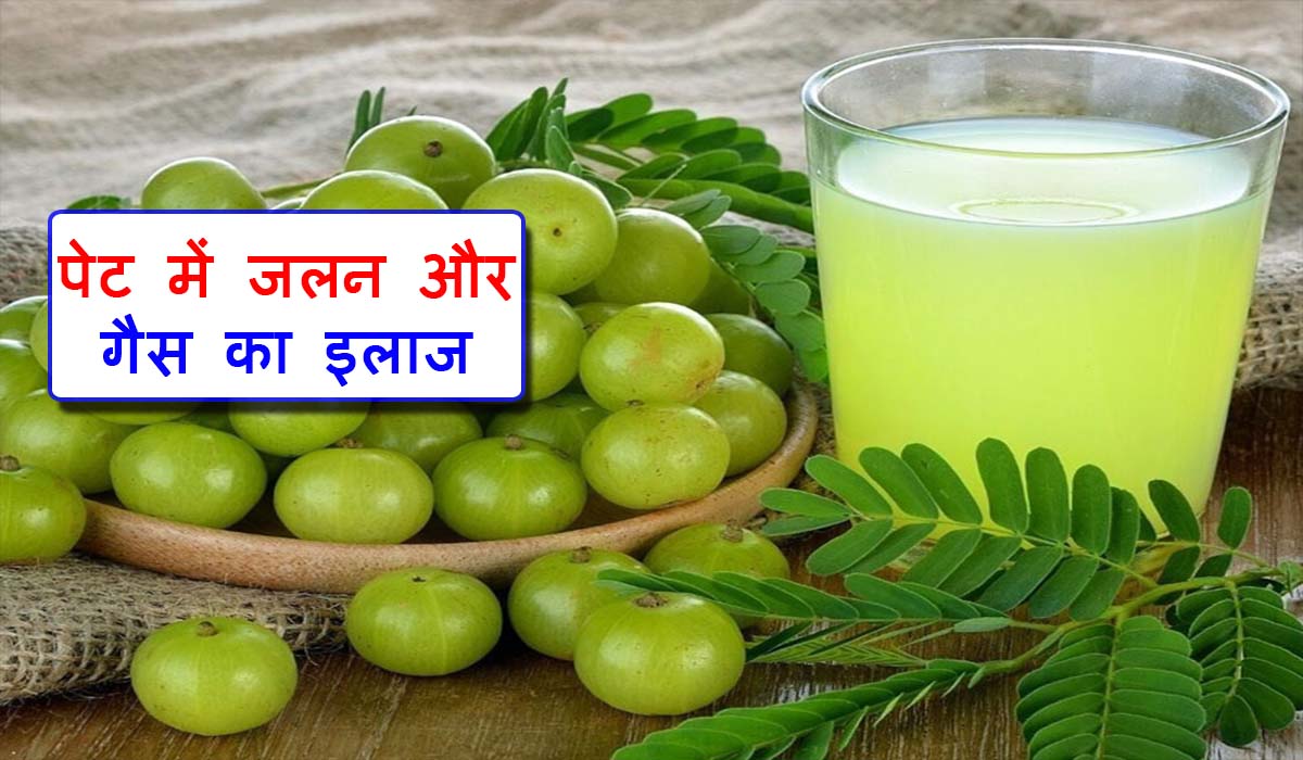 Acidity And Gas Home Remedies in Hindi